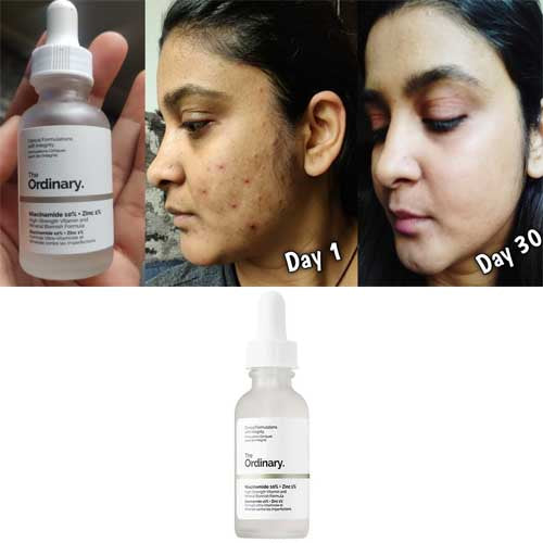 T.O. Niacinamide, 10% + Zinc 1% 30ml